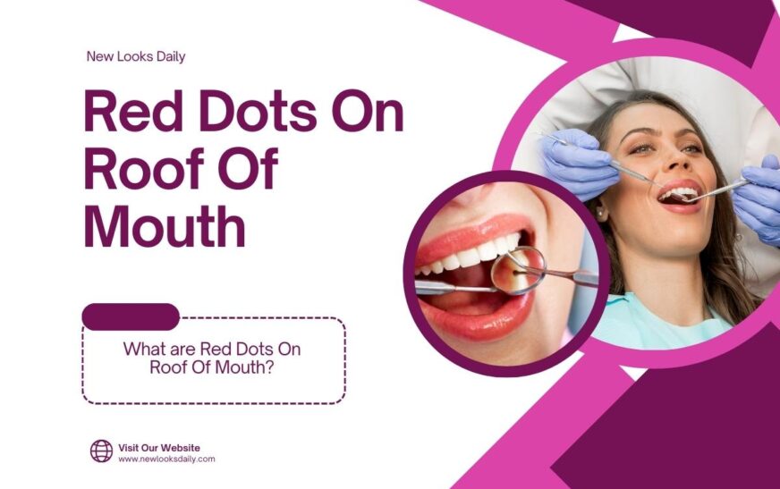 What are Red Dots On Roof Of Mouth?